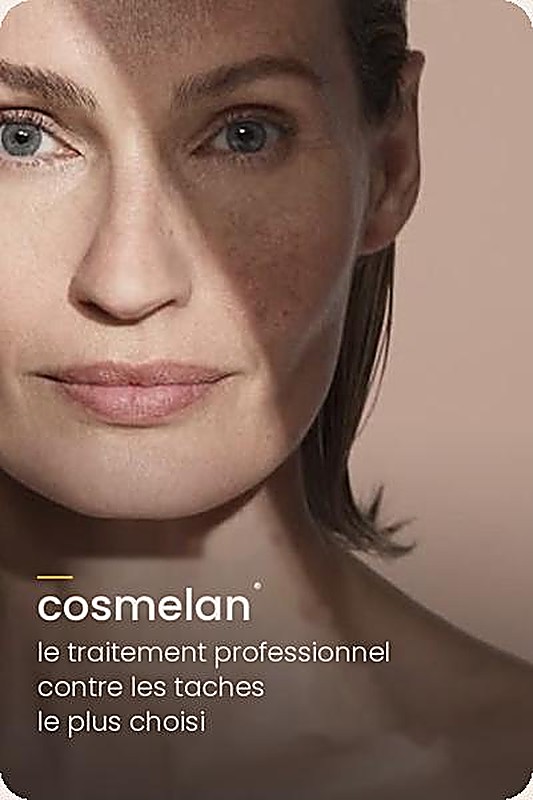 Protocole Cosmelan Mesoestetic contre l'hyperpigmentation, proposé chez Med'Esthétique